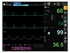 Picture of GIMA BM3 PRO DAUDZPARAMETRA PIESLĒGŠANAS EKRĀNA MONITORS -, 1 gab.